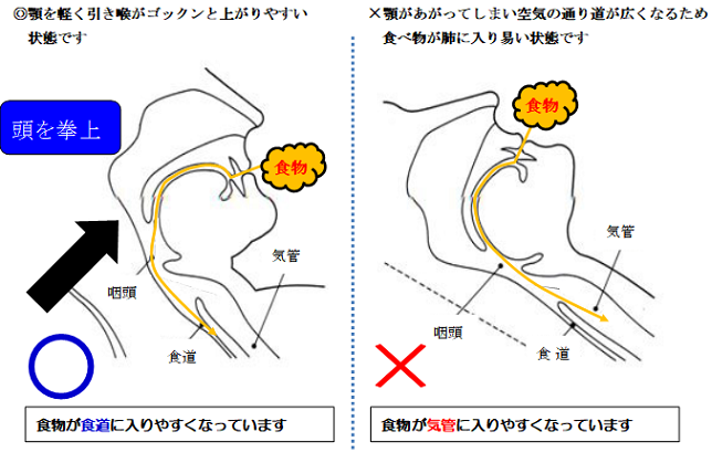 （左）◎顎を軽く引き喉がゴックンと上がりやすい状態です。食物が食道に入りやすくなっています（右）✗顎があがってしまい空気の通り道が広くなるため食べ物が肺に入りやすい状態です。食物が気管に入りやすくなっています