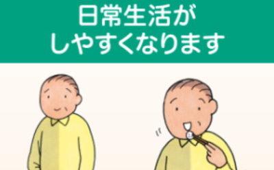 SP ボツリヌス療法について
